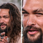 Celebrities with Cleft Lips and Palates