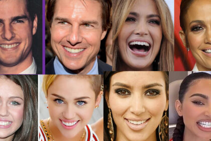 The Secret Behind Perfect Smiles: Celebrities Using Invisalign
