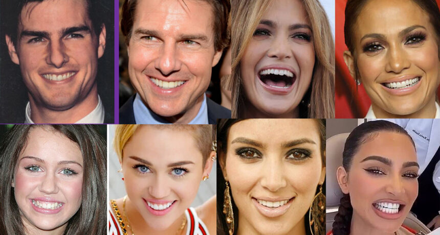The Secret Behind Perfect Smiles: Celebrities Using Invisalign