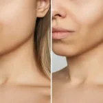High Cheekbones: What They Are, Why They're Attractive, and Everything You Need to Know