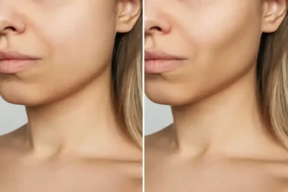High Cheekbones: What They Are, Why They're Attractive, and Everything You Need to Know