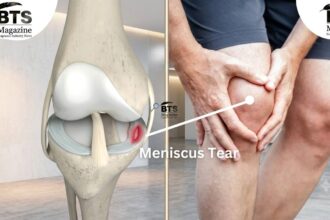 Meniscus: Everything You Need to Know About This Tiny but Mighty Knee Cartilage
